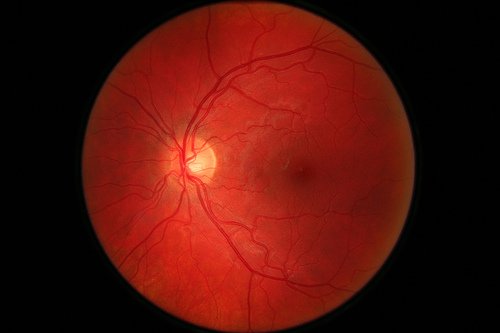 Photo of my retina